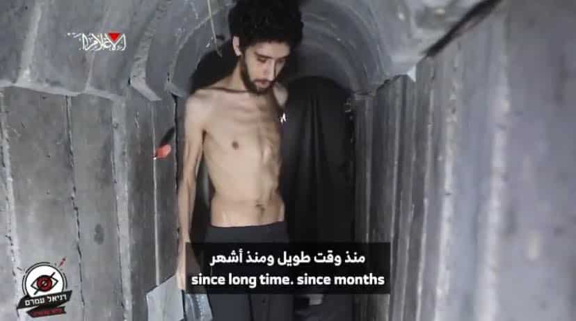 Israel's health report on the hostages is shocking